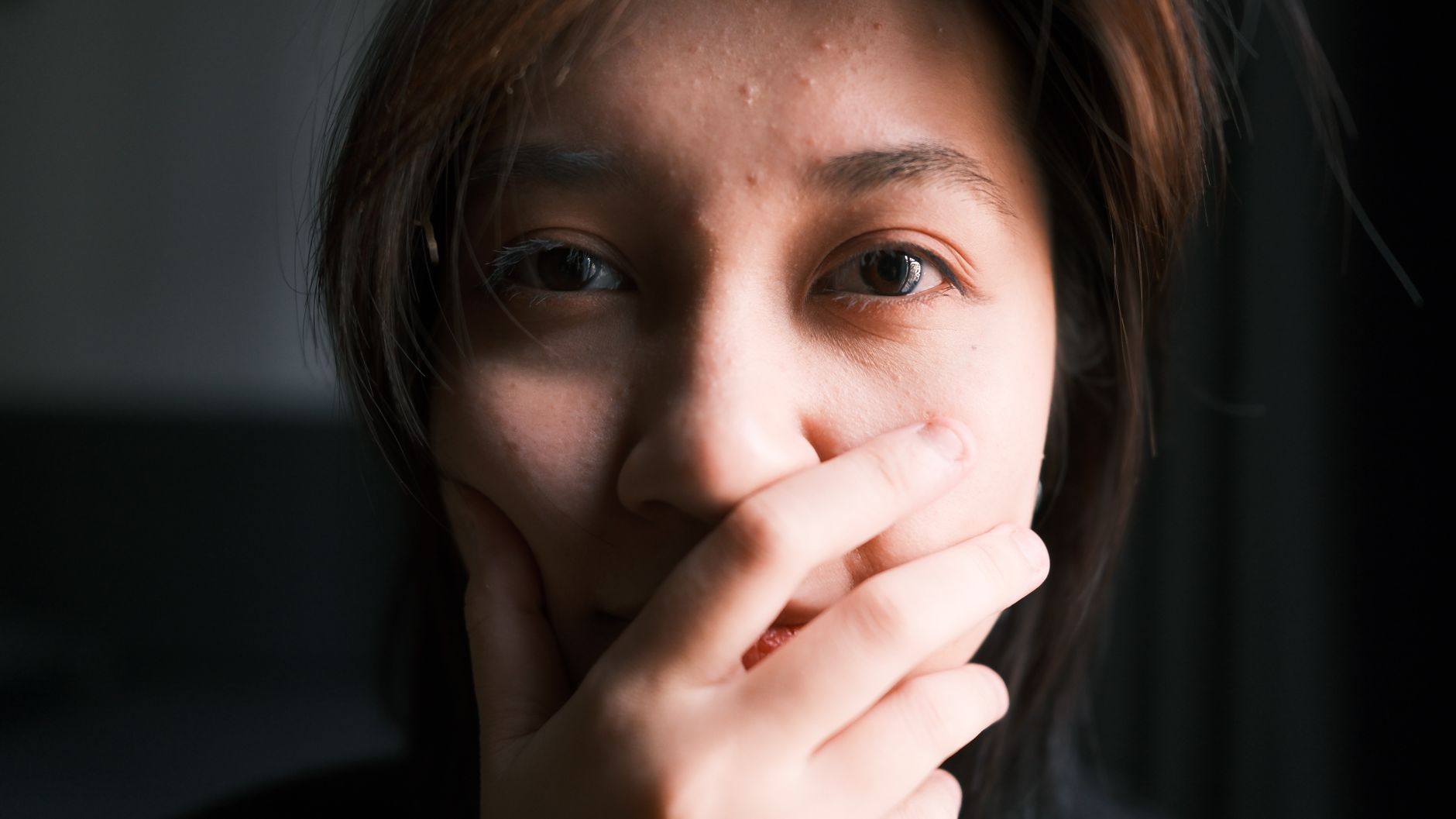 Blind Pimple FAQ: Common Questions and Evidence-Based Answers - Featured image