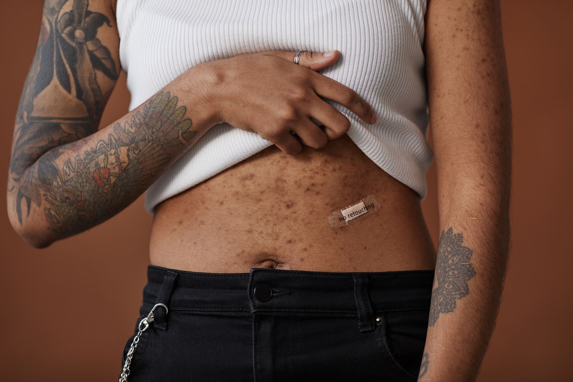 Body Acne Update 2026: Evidence and Open Questions - Featured image