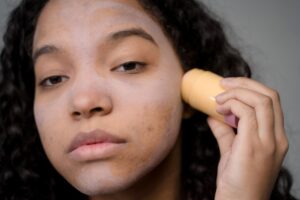 Cosrx Acne: What Current Evidence Actually Supports - Featured image