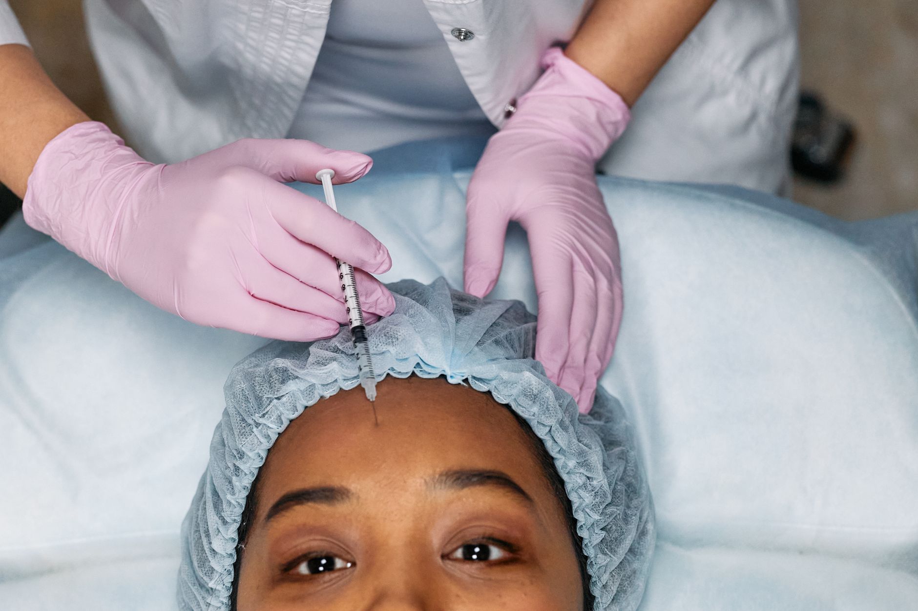 Dermal Fillers for Acne Scars: Temporary Results and Risks - Featured image