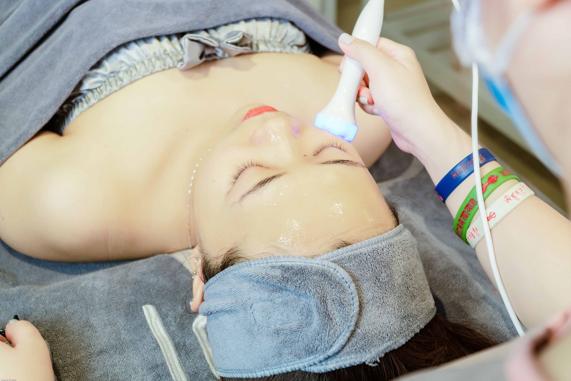 Dual-Wavelength Laser Treatment for Acne Erythema in 2026: Questions Adults With Persistent Acne Can Ask a Dermatologist - Featured image