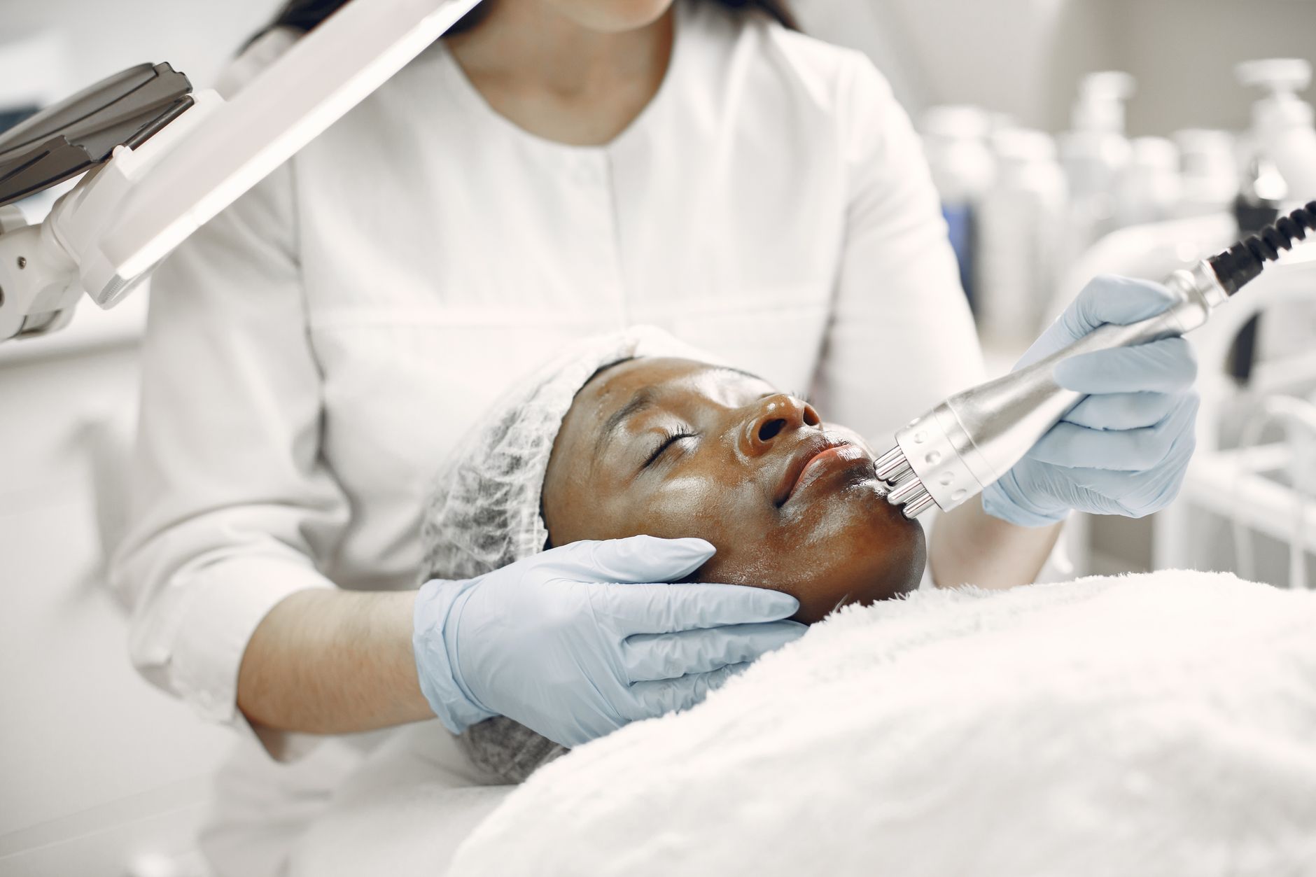 How Long Does Dermatologist-Grade Hydroquinone Take to Fade Acne Marks? - Featured image