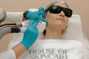 How Much Does Laser Acne Treatment Cost Per Session? - Featured image