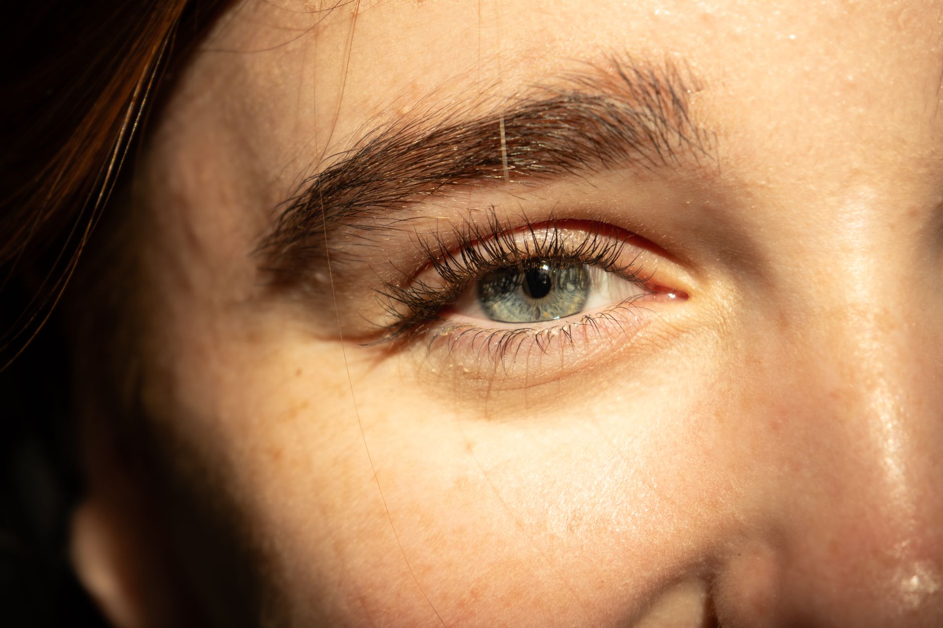 Iris Law's Witch Hazel Skincare Step: What to Consider With Acne and Sensitive Skin - Featured image