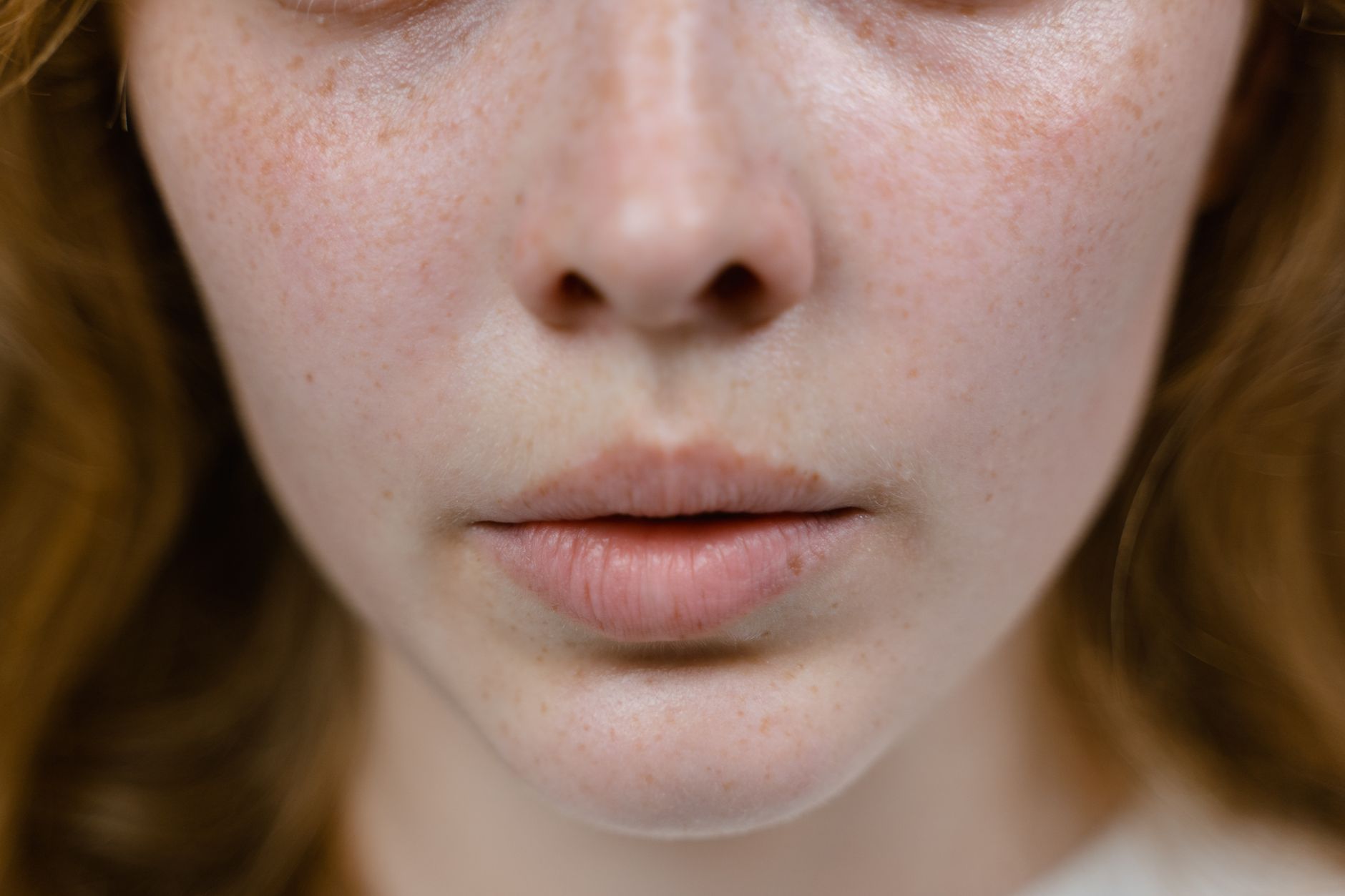 Niacinamide for Rosacea: What the Evidence Actually Shows - Featured image