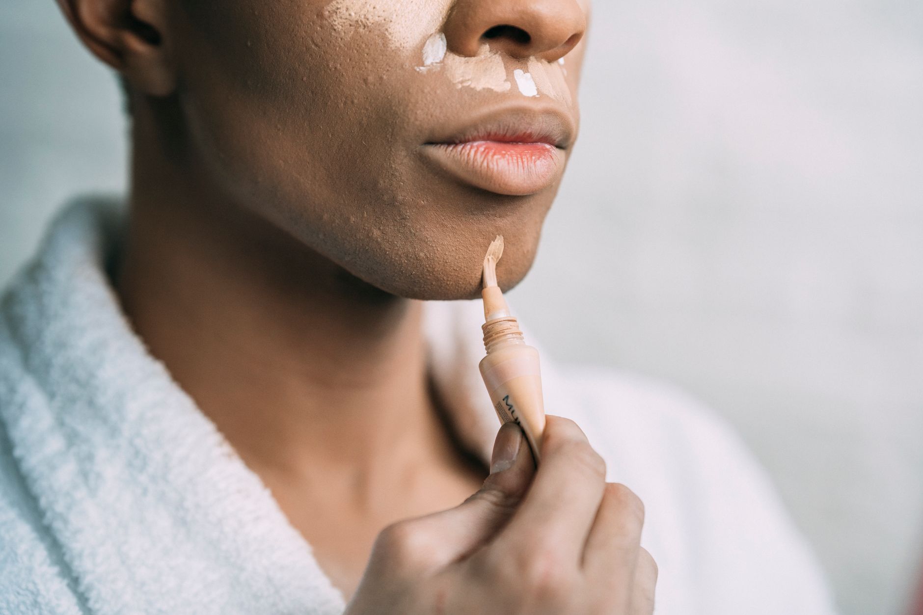 Skin-Tone Equity Gaps in 2026 Acne AI Research: Privacy and Photo-Data Questions for Parents Using Acne Apps for Teens - Featured image