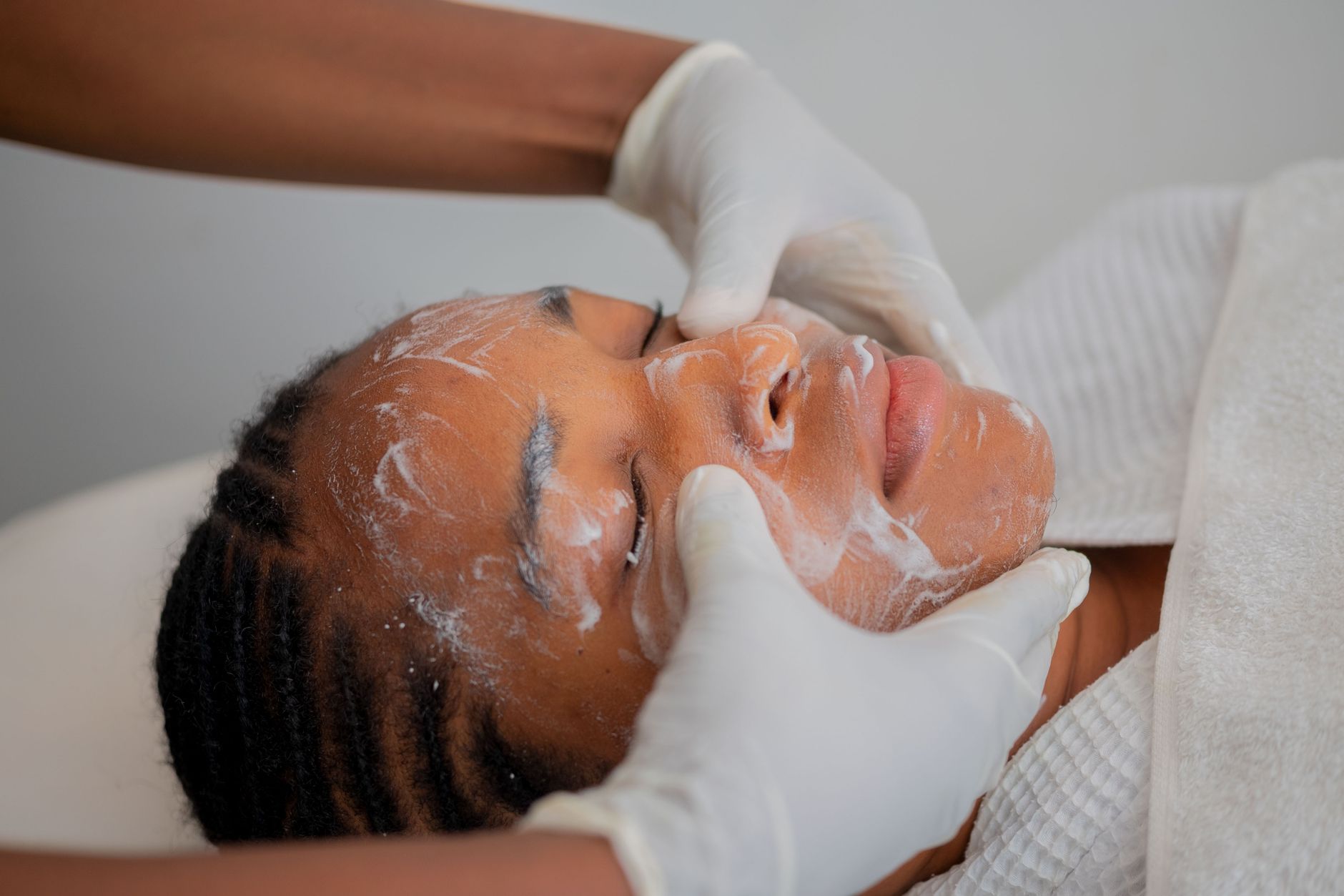 The 160-Participant Acne Scar Combination Trial Published in 2026: What the Trial Means for People With Rolling Acne Scars - Featured image