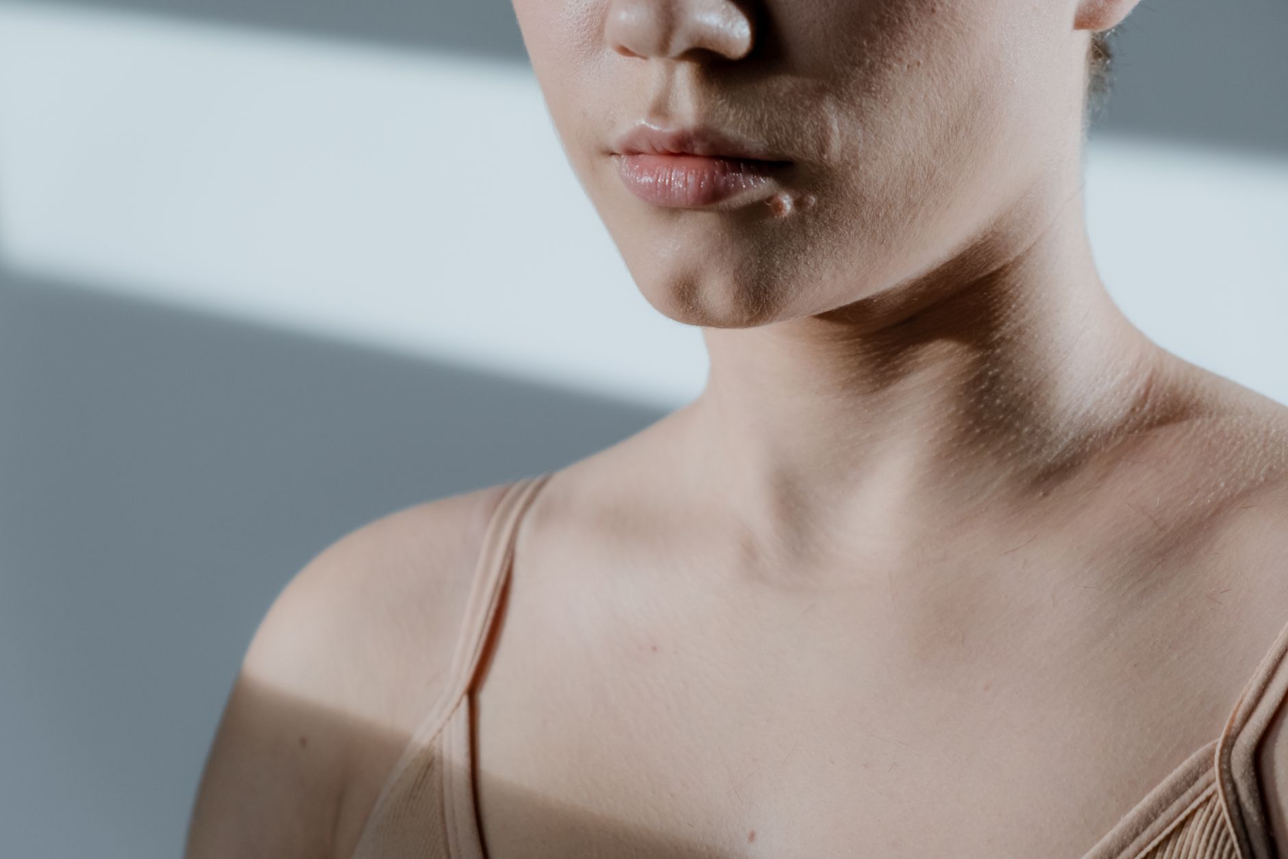 Why Is There a Hard Lump Under My Skin After a Pimple Heals? - Featured image